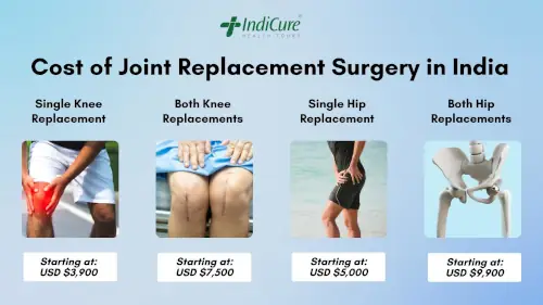 Cost of Joint Replacement Surgery in India Cost of Joint Replacement Surgery in India